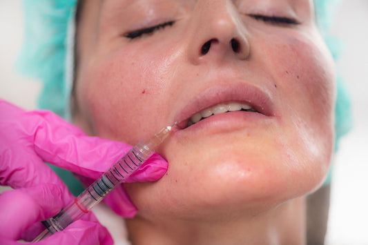 dermal filler swelling