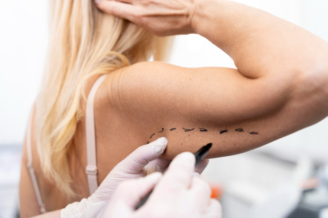 Arm Contouring