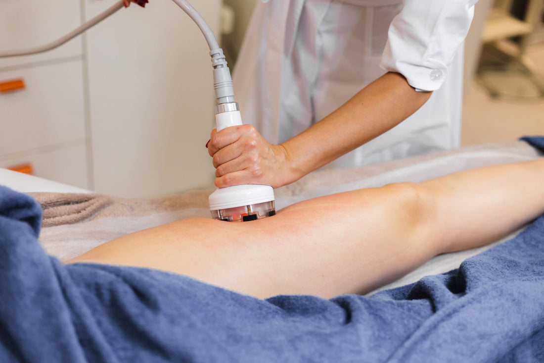CoolSculpting