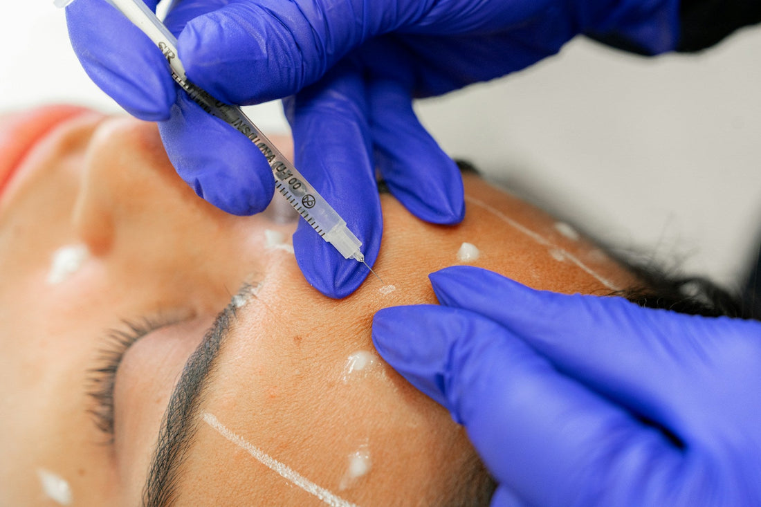 dermal filler