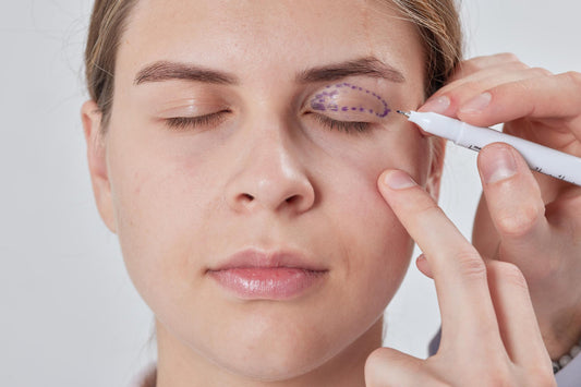 eyelid surgery