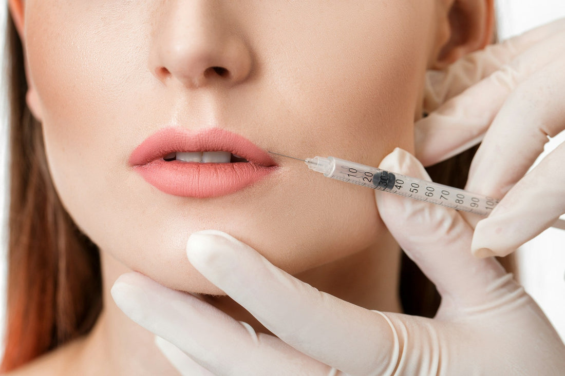 lip filler