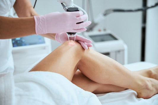 laser hair removal