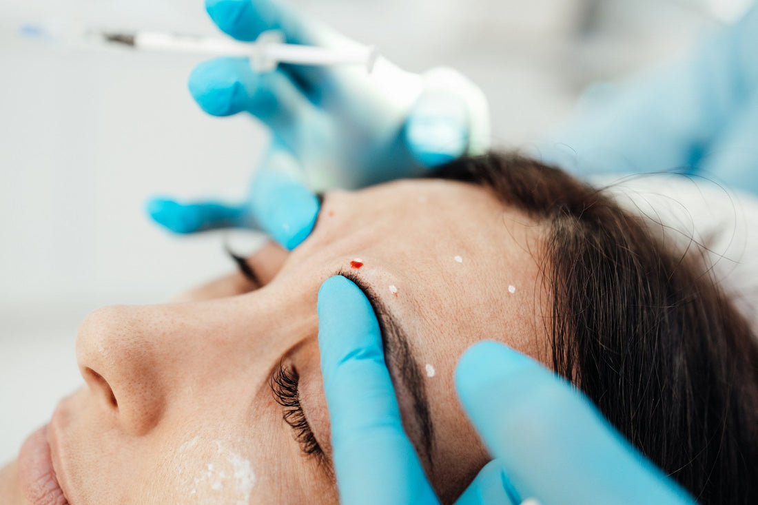 Dermal Fillers 
