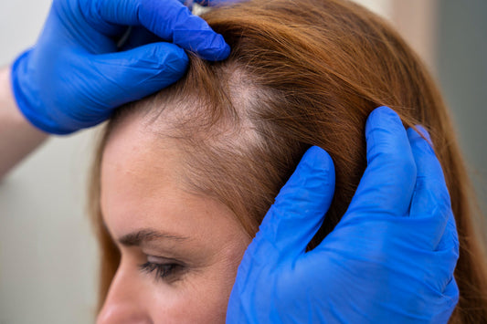 hair restoration