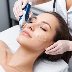 Laser Hair Removal